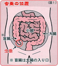 一般財団法人 脳神経疾患研究所 総合南東北病院 知るほどtopics 盲腸って何 急性虫垂炎について