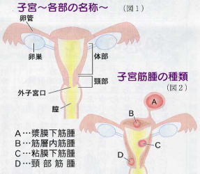 子宮の病気 子宮筋腫 子宮内膜症 子宮頚がん 子宮体がん